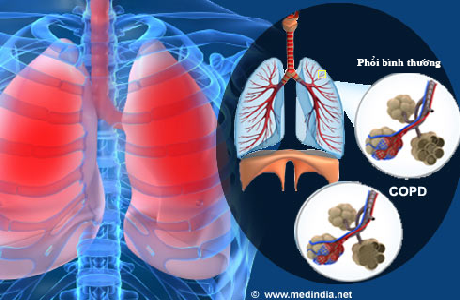 Bài báo cáo của GS. TSKH. BS Dương Quý Sỹ – Hiệu trưởng nhà trường tại Bệnh viện Phổi Trung ương.